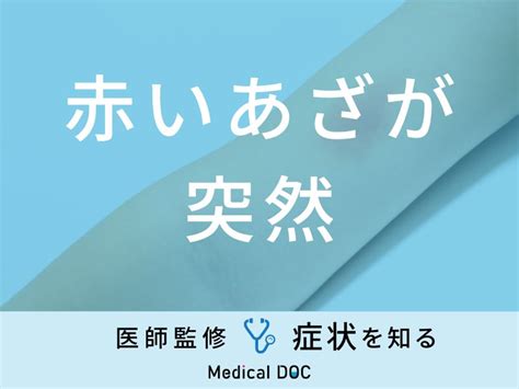 赤痣|「赤いあざが突然」できる原因はご存知ですか？医師。